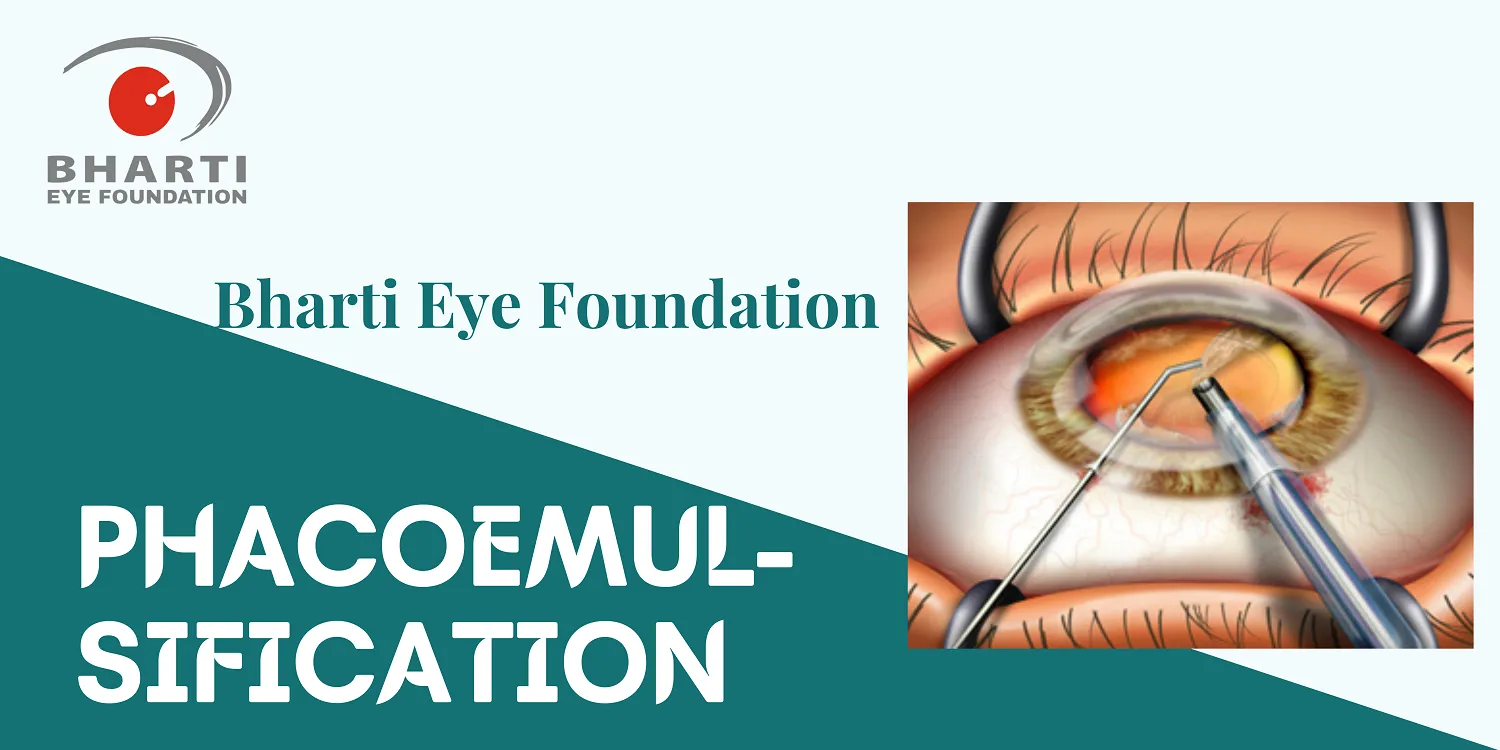 Phacoemulsification Banner