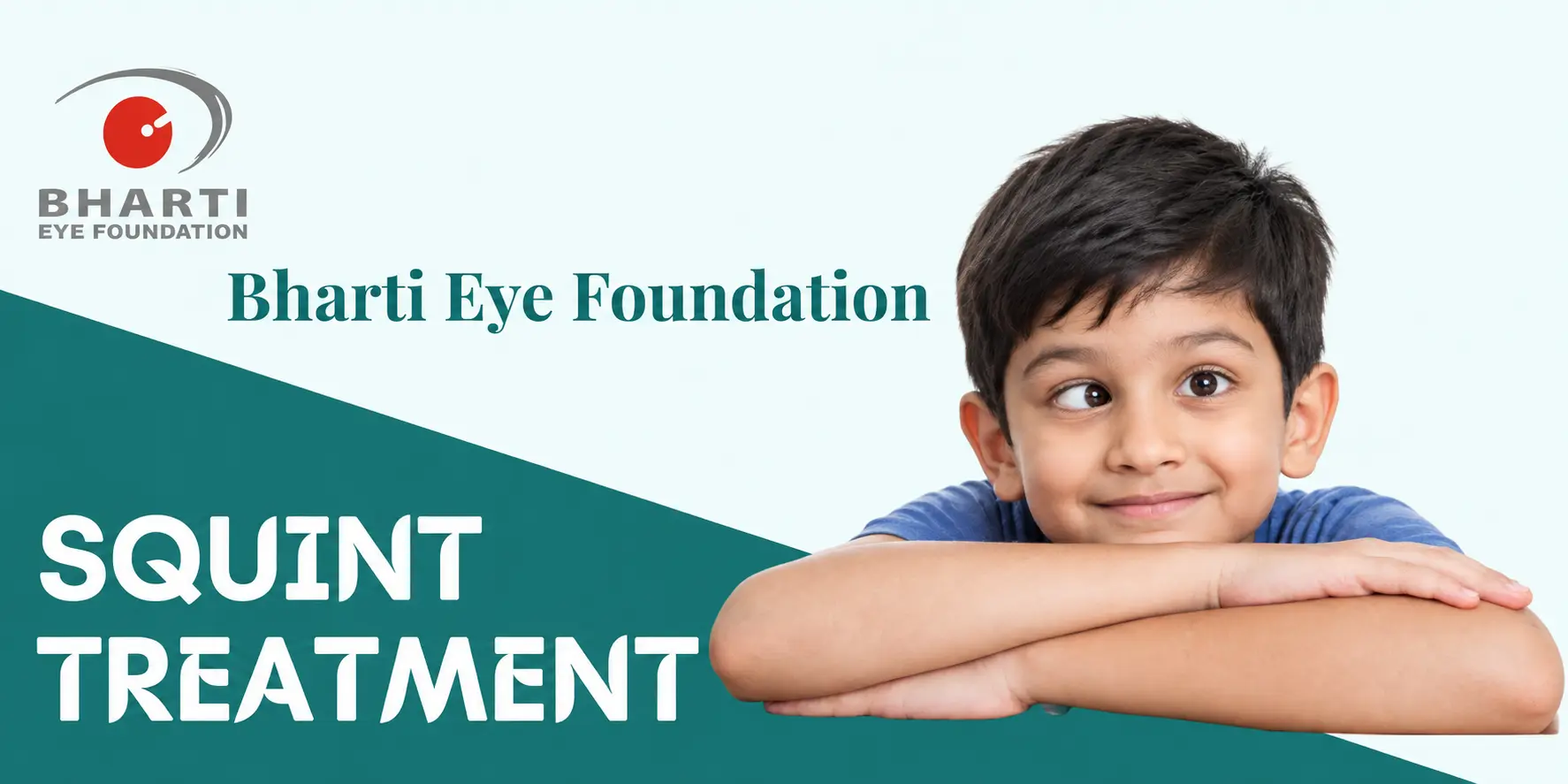 Squint Treatment Banner