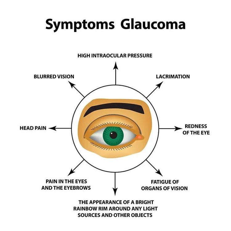 Symptoms Of Glaucoma